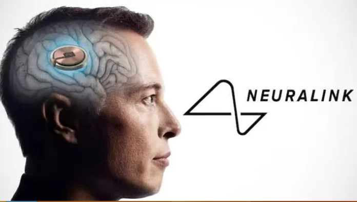 Neuralink, la sociÃ©tÃ© dâ€™Elon Musk, a posÃ© une puce dans le cerveau dâ€™un humain